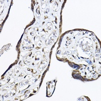 TRF4 Rabbit Polyclonal Antibody