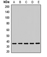 LRRC59 Rabbit Polyclonal Antibody