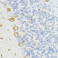 LRRC59 Rabbit Polyclonal Antibody