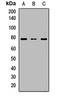 UGT1A6 Rabbit Polyclonal Antibody
