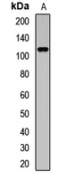 TRPC5 Rabbit Polyclonal Antibody