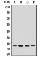 NACA1 Rabbit Polyclonal Antibody