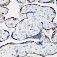 Clusterin Rabbit Polyclonal Antibody