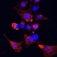Clusterin Rabbit Polyclonal Antibody