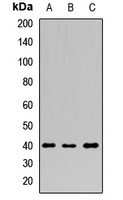 PDX1 Rabbit Polyclonal Antibody