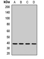 Glycogenin-1 Rabbit Polyclonal Antibody