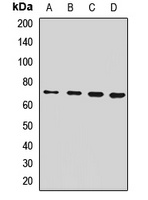 SLC11A2 Rabbit Polyclonal Antibody