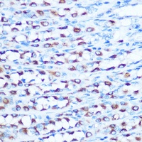 SLC11A2 Rabbit Polyclonal Antibody