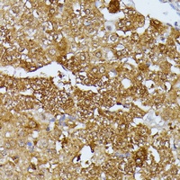Septin 4 Antibody
