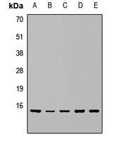 RPS15A Rabbit Polyclonal Antibody