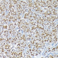 RPS15A Rabbit Polyclonal Antibody