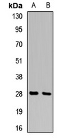 14-3-3 sigma Rabbit Polyclonal Antibody