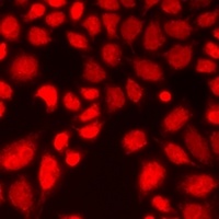 14-3-3 sigma Rabbit Polyclonal Antibody