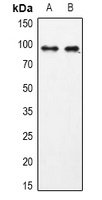 USP13 Rabbit Polyclonal Antibody