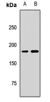 KIF14 Rabbit Polyclonal Antibody