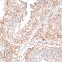 KIF14 Rabbit Polyclonal Antibody