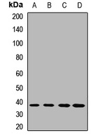 DDAH1 Rabbit Polyclonal Antibody