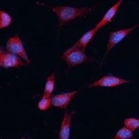 DDAH1 Rabbit Polyclonal Antibody