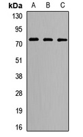 LRRC4 Rabbit Polyclonal Antibody
