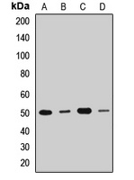 DDX47 Rabbit Polyclonal Antibody