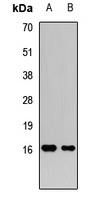 FGF21 Antibody