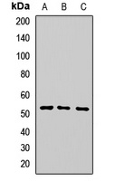 CNDP2 Rabbit Polyclonal Antibody
