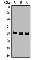 MTHFD2 Rabbit Polyclonal Antibody