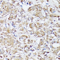 MTHFD2 Rabbit Polyclonal Antibody