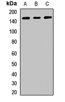 RBM6 Rabbit Polyclonal Antibody