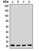 REEP5 Rabbit Polyclonal Antibody