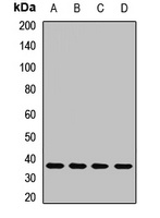 Thymidylate Synthase Rabbit Polyclonal Antibody