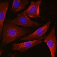 Thymidylate Synthase Rabbit Polyclonal Antibody