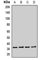 EXOSC2 Rabbit Polyclonal Antibody