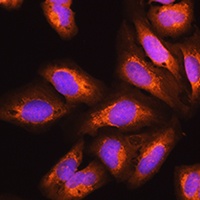 EXOSC2 Rabbit Polyclonal Antibody