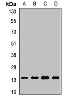 PDF Rabbit Polyclonal Antibody
