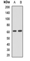 P4HA1 Rabbit Polyclonal Antibody