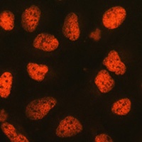 P4HA1 Rabbit Polyclonal Antibody