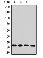 Rhodanese Rabbit Polyclonal Antibody