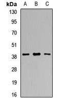 RCN1 Rabbit Polyclonal Antibody