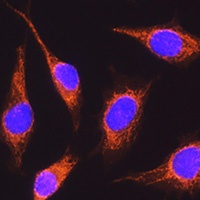 RCN1 Rabbit Polyclonal Antibody