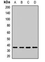 PSMD14 Rabbit Polyclonal Antibody