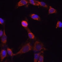 PSMD14 Rabbit Polyclonal Antibody