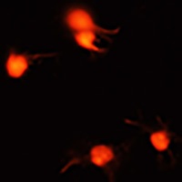 BDNF Rabbit Polyclonal Antibody