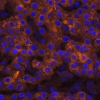 Transthyretin Rabbit Polyclonal Antibody