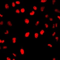 MCM7 Rabbit Polyclonal Antibody