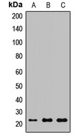 NGAL Rabbit Polyclonal Antibody