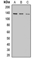 CHAMP1 Rabbit Polyclonal Antibody