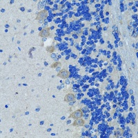 Nestin Antibody