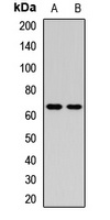 GLMN Rabbit Polyclonal Antibody