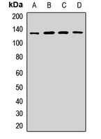 HIP1R Rabbit Polyclonal Antibody